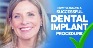 Tips for a successful dental implant procedure