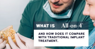 What is All-on-4®️ and How Does it Compare with Traditional Implant Treatment?