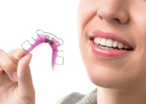 removable dental appliance
