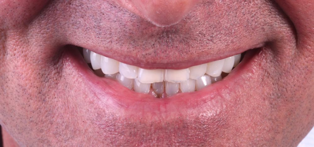 before treatment