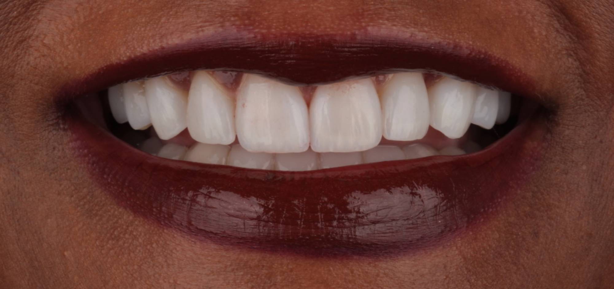 afterbefore treatment