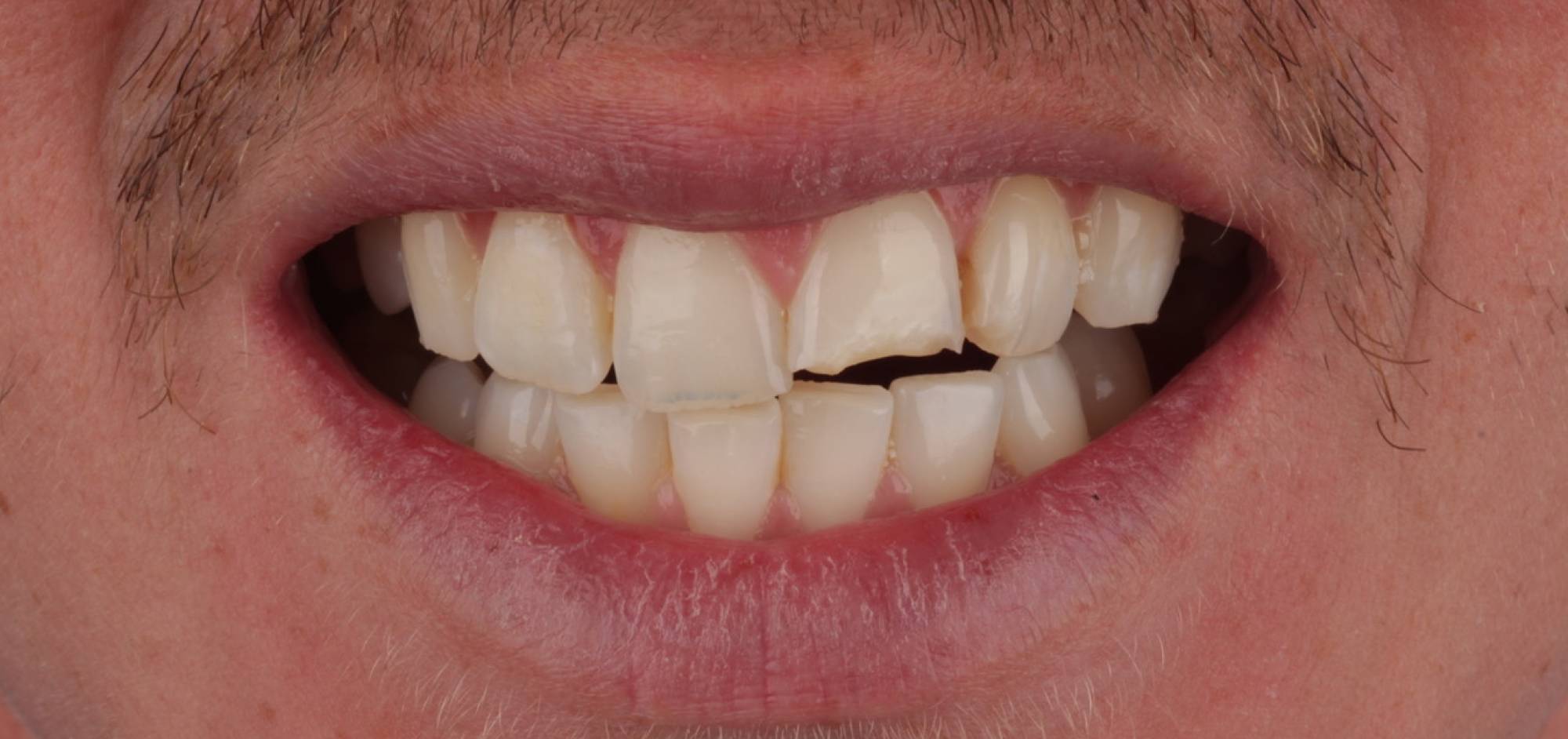before treatment
