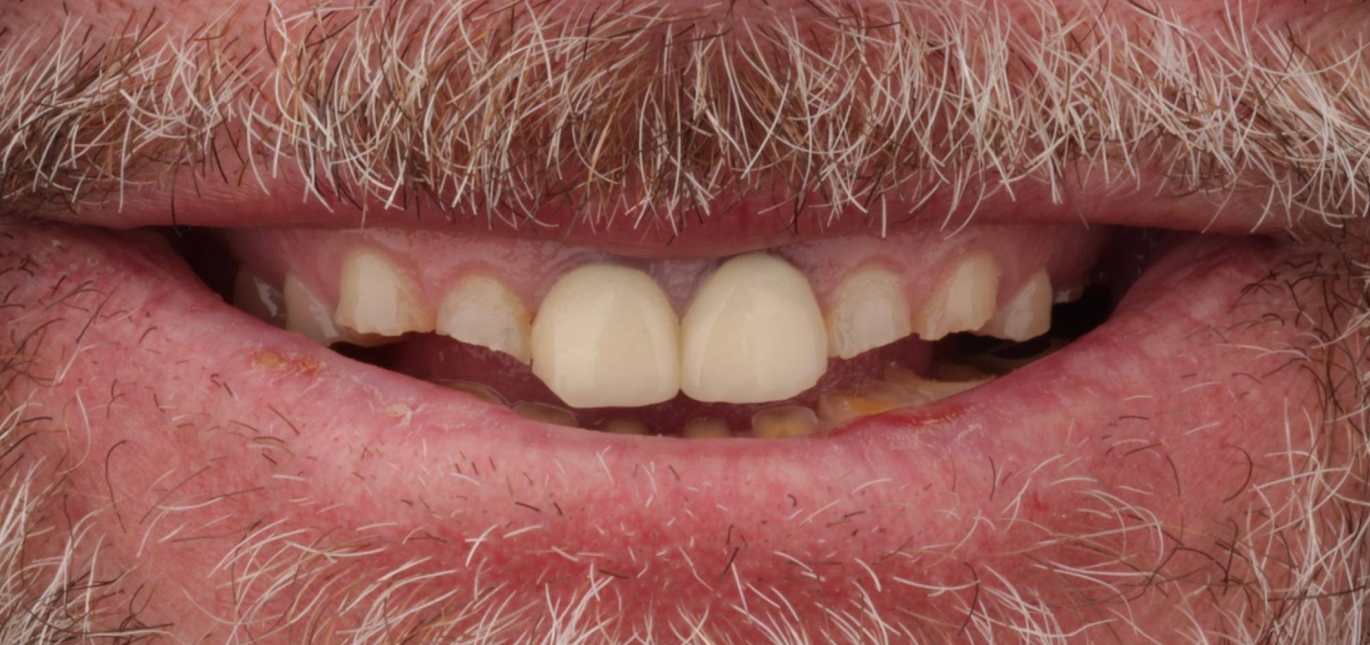 before treatment